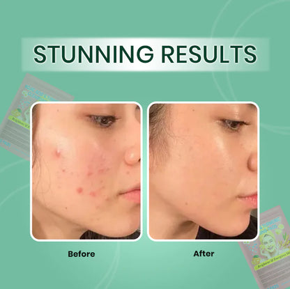 LAYZA™ Turmeric & Kojic Acid Pads (Original)