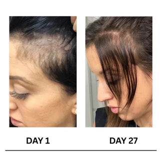 Layza™ Scalpy Boost Hair Growth Serum (Original)