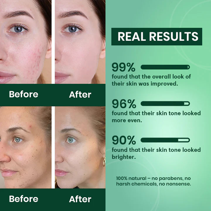 LAYZA™ Turmeric & Kojic Acid Pads (Original)