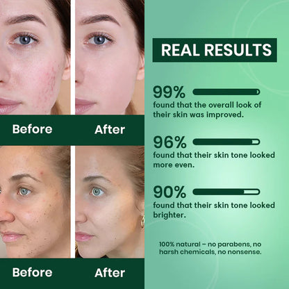 LAYZA™ Turmeric & Kojic Acid Pads (Original)