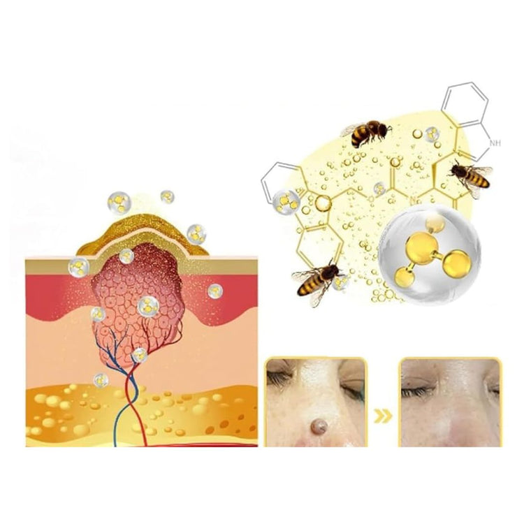 HOUKEA™Bee Venom Cream (Original)